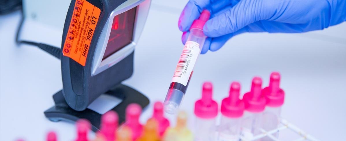 Blutproben von Hepatitis-Kranken werden eingescannt. 
