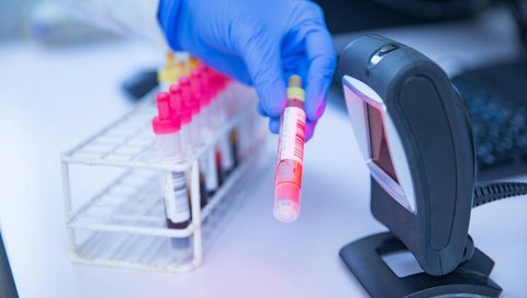 A gloved hand can be seen holding a tube of blood in front of a reader so that the code can be scanned.