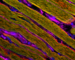 Copyright, AG Nayak, MHH, MZP, Skelettmus