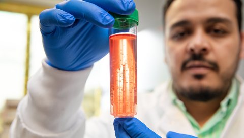Dr. Fawaz Saleh is holding a tubular container containing white cell clusters in red culture medium. 