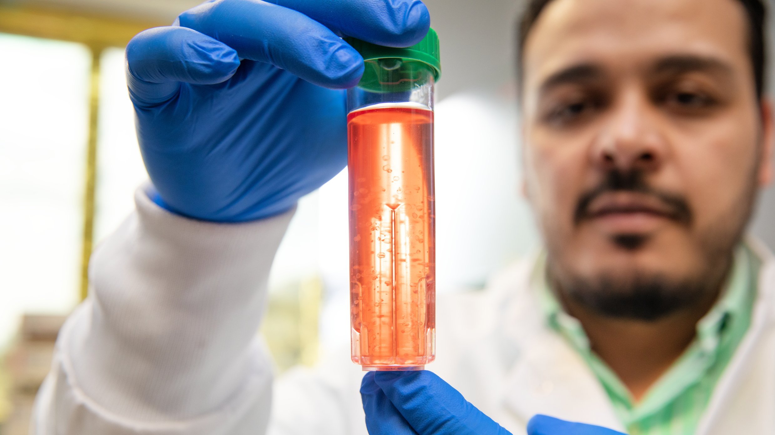 Dr. Fawaz Saleh is holding a tubular container containing white cell clusters in red culture medium. 