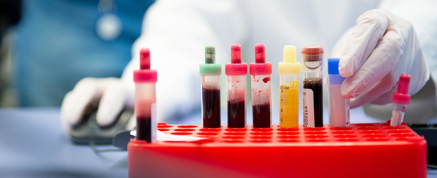 Blood and urine samples in various laboratory tubes are held in a red sample holder, whilst a healthcare professional places a sample into the holder.