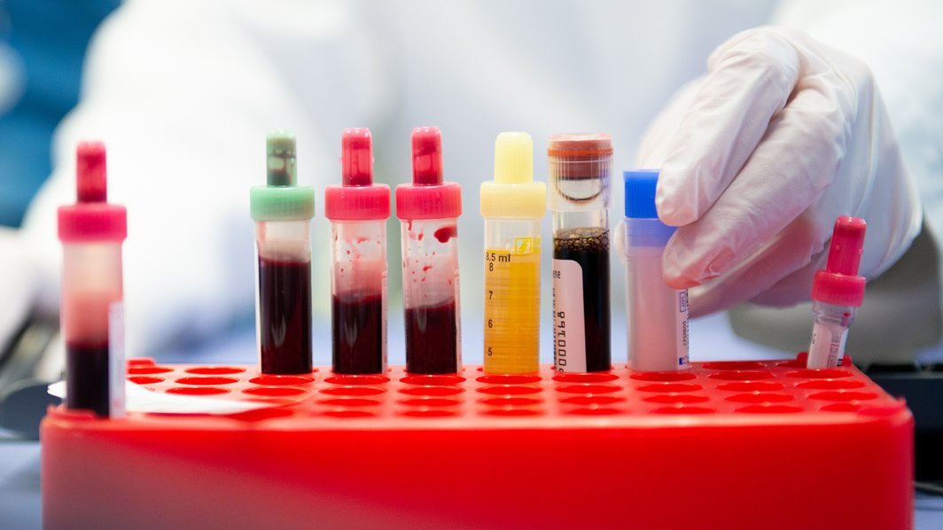 Blut- und Urinproben in verschiedenen Laborröhrchen stehen in einem roten Probenhalter, während eine medizinische Fachkraft eine Probe in den Halter stellt. 