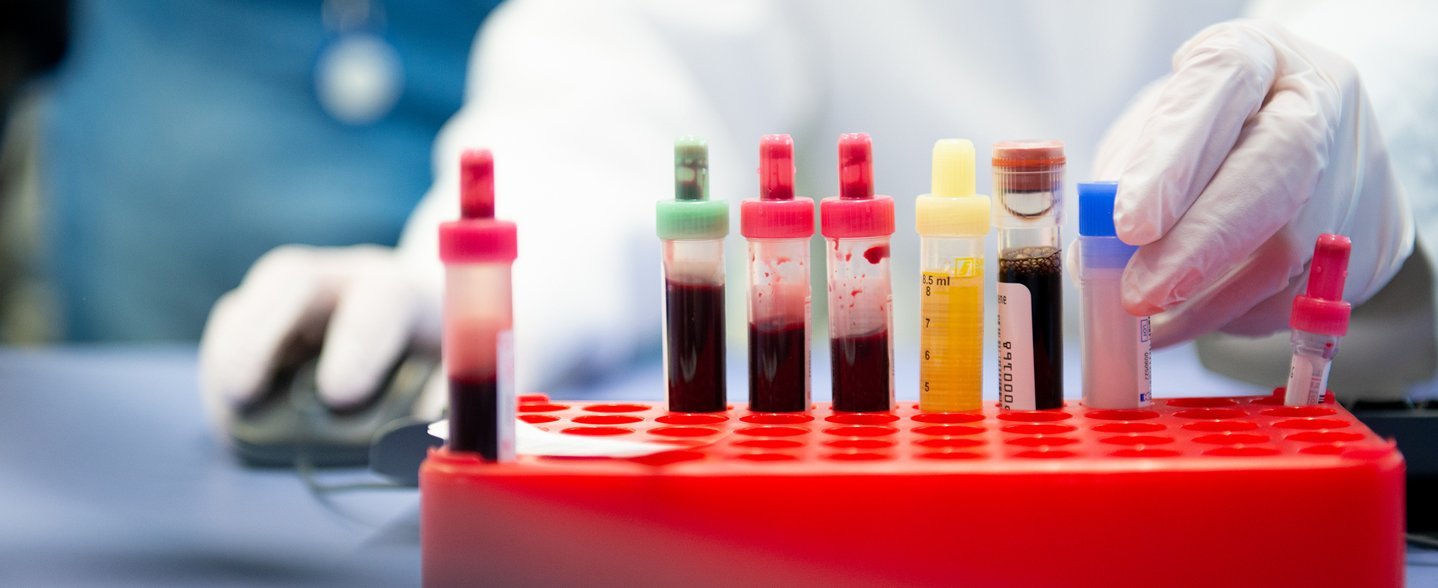 Blut- und Urinproben in verschiedenen Laborröhrchen stehen in einem roten Probenhalter, während eine medizinische Fachkraft eine Probe in den Halter stellt. 