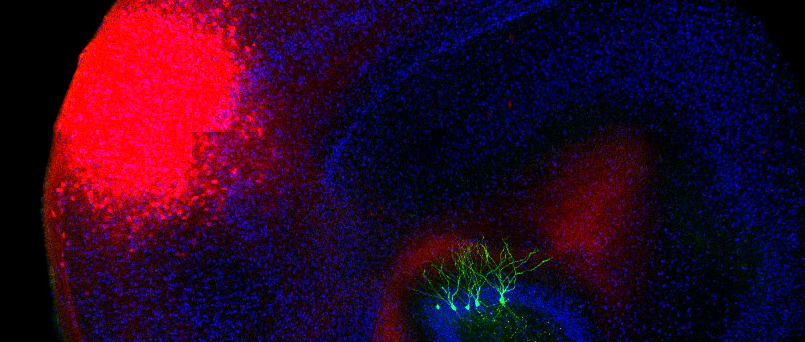 Copyright: Prof. M. Lenz/Neuroanatomie und Zellbiologie/MHH