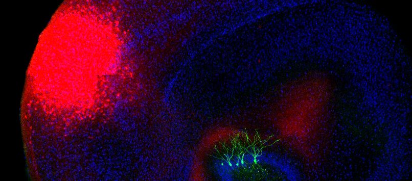Copyright: Prof. M. Lenz/Neuroanatomie und Zellbiologie/MHH Copyright: Prof. M. Lenz/Neuroanatomie und Zellbiologie/MHH
