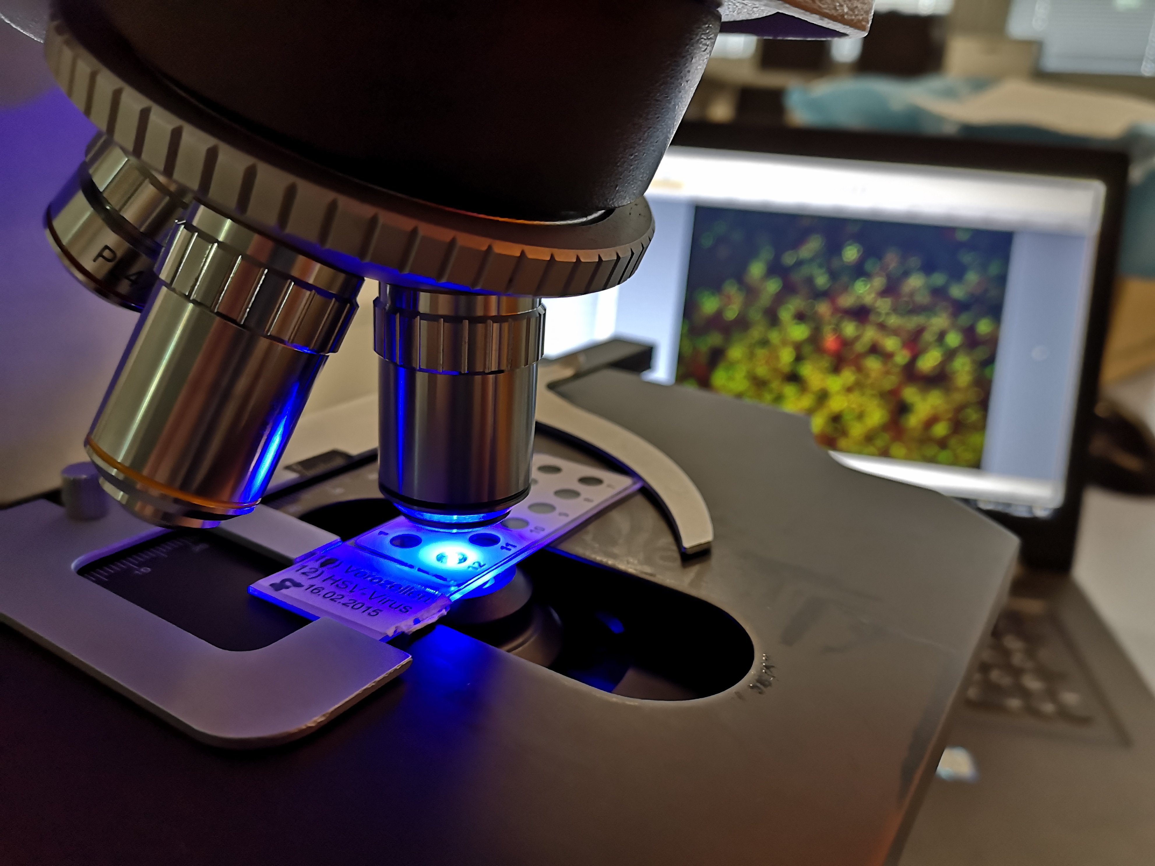 Das Bild zeigt ein Präparat unter einem Fluoreszenzmikroskop. Im Hintergrund ist das aufgenommene Bild auf einem Laptop zu sehen.