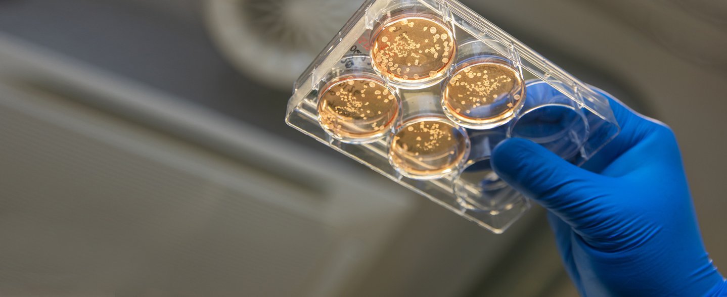 White cell clusters in red culture medium 