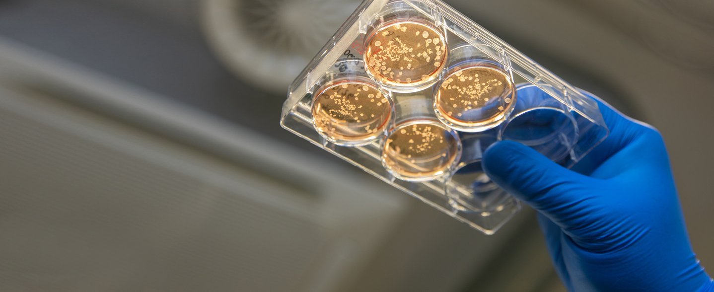 Eine Hand in blauem Handschuh hält einen durchsichtigen Behälter mit weißen Zellverbünden in roter Flüssigkeit