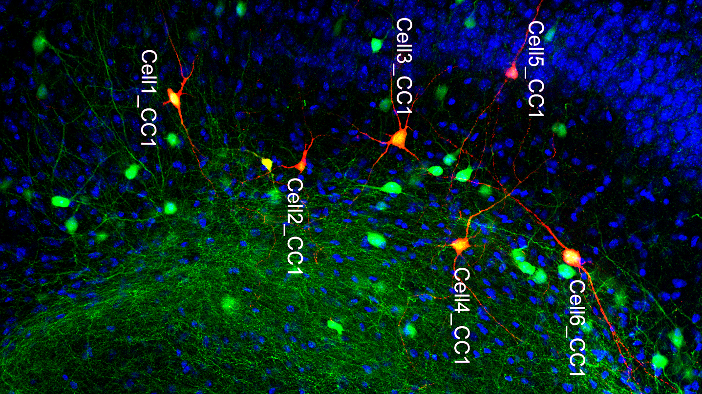 Copyright: Prof. M. Lenz/Neuroanatomie undZellbiologie/MHH