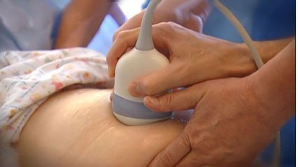 Pränataldiagnostik, (c)RodeB|MHH