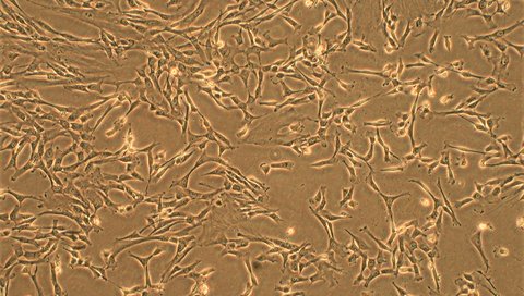 Mikroskopische Aufnahme der kultivierten menschlichen mesenchymalen Stammzellen aus der Spender-Nabelschnur, deren Stammzellprodukte im konditionierten Medium für diesen Therapieansatz verwendet wurden.