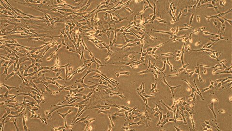 A microscopic image of the cultured human mesenchymal stem cells from the donor umbilical cord, whose stem cell products in conditioned medium were used for this therapeutic approach.