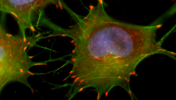 Immunfluoreszenz gefärbte Zellen, Zellkern blau, Aktin-Zytoskelett grün, fokale Adhäsionen rot