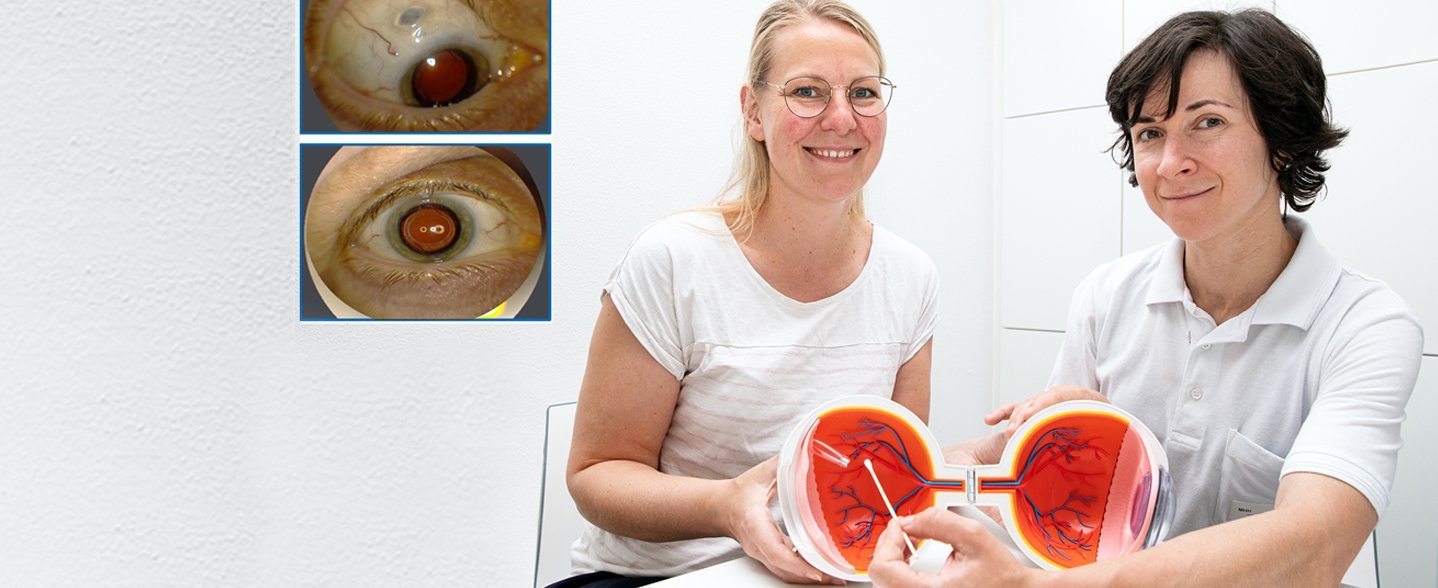 Zwei Frauen mit einem aufklappbaren Augenmodell.