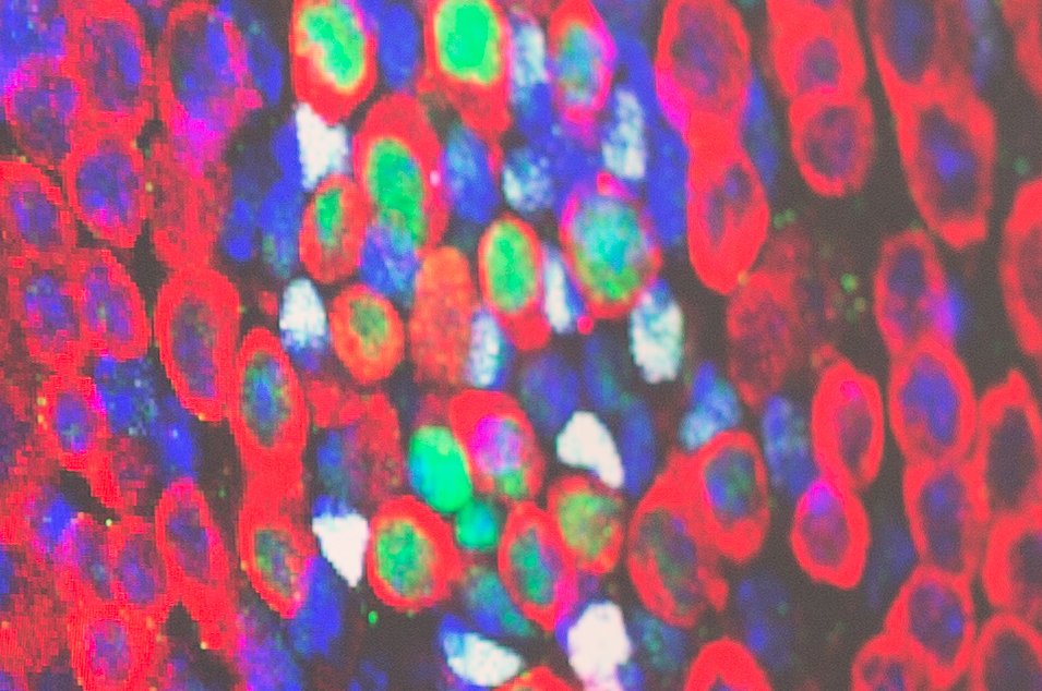 Copyright: Trulley, Philipp / Zellbiochemie / MHH