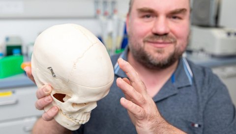 Prof. Dr. Christoph Garbers is holding a model of a human skull in his hands.
