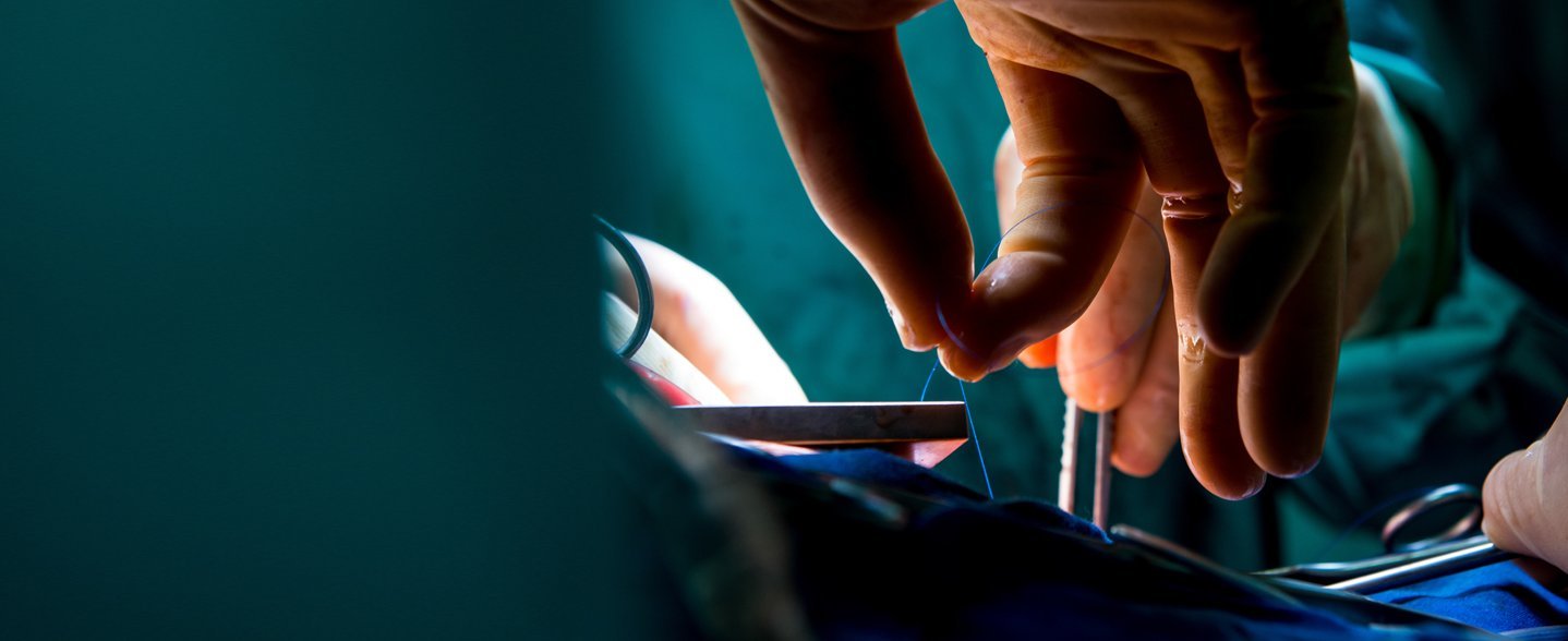 Nahaufnahme im OP, eine Hand hält einen dünnen OP-Faden.