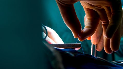 Close-up in the operating theater, one hand holds a thin surgical suture. 