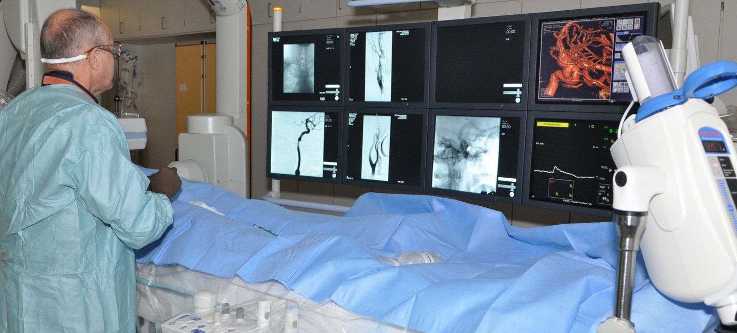 Angiographie Neuroradiologie; Copyright: Steinlandt, Heike/Neuroradiologie/MHH