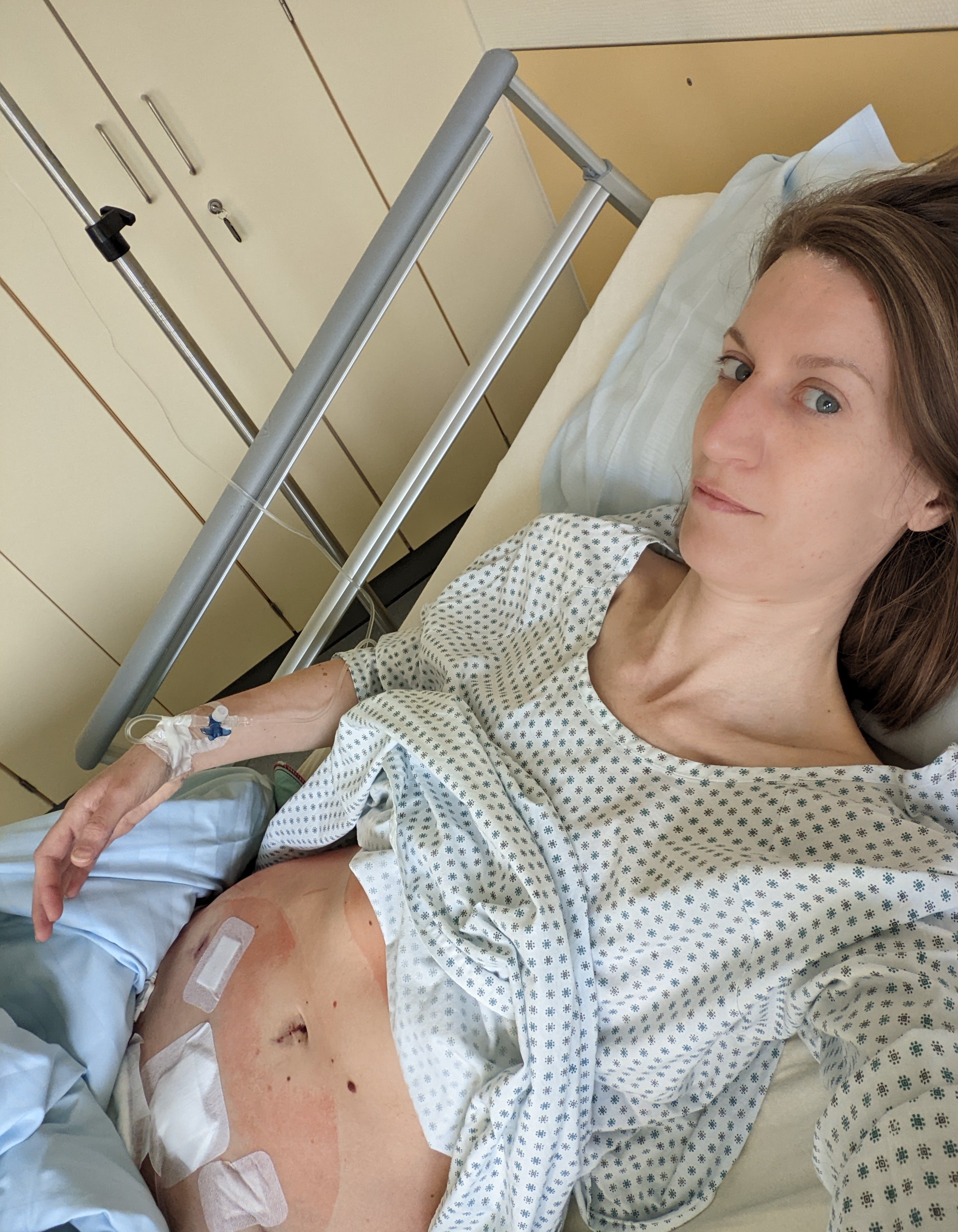 Verena Nabert liegt nach der OP im Krankenhausbett man sieht ihre OP Pflaster auf dem Bauch.