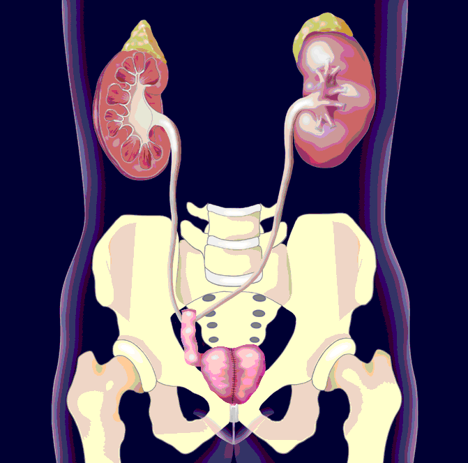 Neoblase, Copyright: Klinik für Urologie/MHH