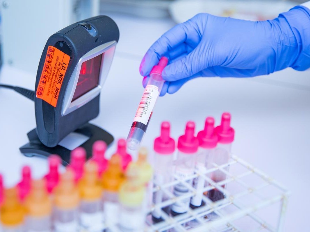 Ein Röhrchen mit Blut wird von einer Hand mit einem weißen Handschuh vor einen Scanner gehalten.
