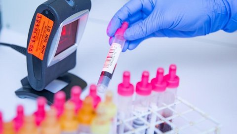 Ein Röhrchen mit Blut wird von einer Hand mit einem weißen Handschuh vor einen Scanner gehalten.