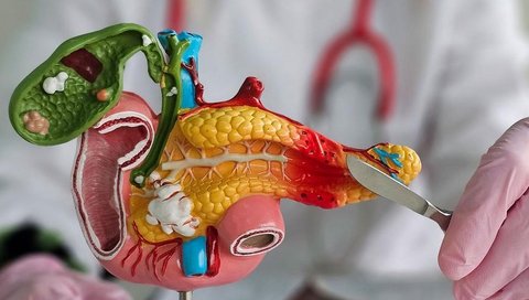 Organe und ihre Gesundheit, darum geht es bei der Patientenuniversität. Hier im Bild ist ein Modell der Bauchspeicheldrüse zu sehen, im Hintergrund steht eine Person im weißen Arztkittel, die von hinten ein chirurgisches Messer ans Modell hält. 