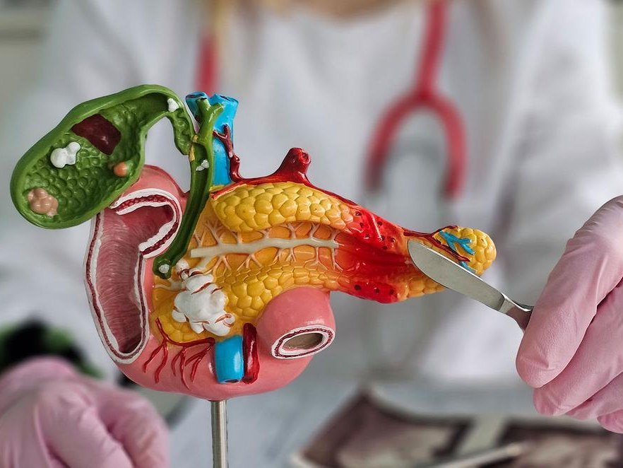 Organe und ihre Gesundheit, darum geht es bei der Patientenuniversität. Hier im Bild ist ein Modell der Bauchspeicheldrüse zu sehen, im Hintergrund steht eine Person im weißen Arztkittel, die von hinten ein chirurgisches Messer ans Modell hält. 