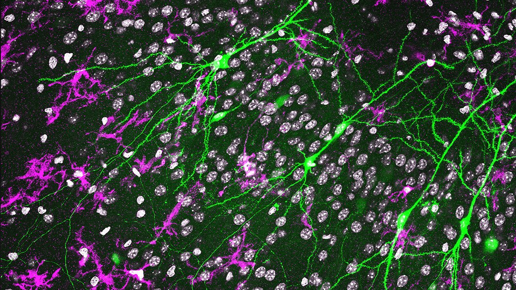 Copyright: Prof. M. Lenz/Neuroanatomie und Zellbiologie/MHH