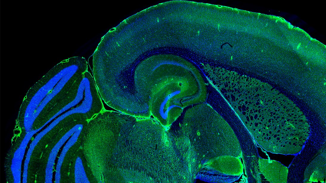 Copyright: Prof. M. Lenz/Neuroanatomie und Zellbiologie/MHH