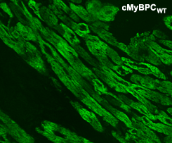 heart cells with cMyBPc stain