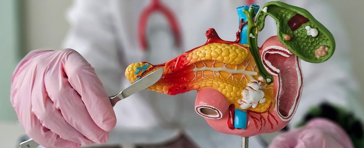 Organe und ihre Gesundheit, darum geht es bei der Patientenuniversität. Hier im Bild ist ein Modell der Bauchspeicheldrüse zu sehen, im Hintergrund steht eine Person im weißen Arztkittel, die von hinten ein chirurgisches Messer ans Modell hält. Copyright: NMK-Studio auf shutterstock   
