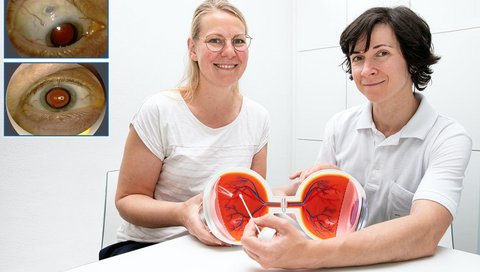 Zwei Frauen mit einem aufklappbaren Augenmodell.