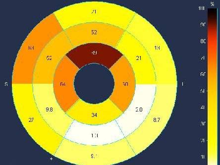 Copyright:Diagnostische und Interventionelle Radiologie/MHH