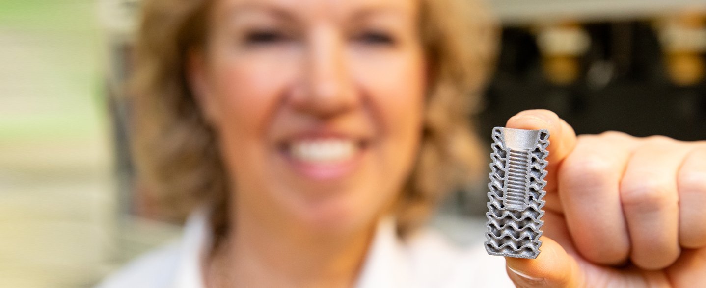 Eine Frau hält ein 3-D-Modell eines Titan-Implantates in der Hand, das die an die Belastungen optimal angepasste Innenstruktur zeigt. 