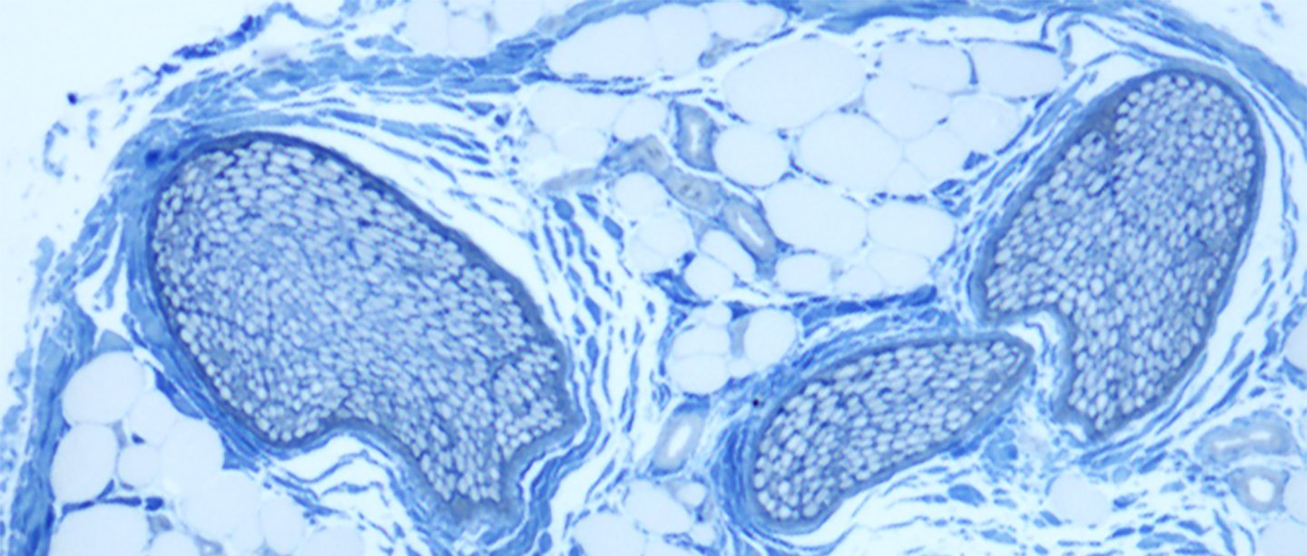 Copyright: Prof. M. Lenz/Neuroanatomie und Zellbiologie/MHH