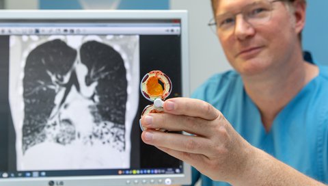 Privatdozent Dr. Felix Ringshausen sitzt vor dem Röntgenbild der Lunge einer PCD-Betroffenen und zeigt ein Modell eines durch Schleim verstopften Atemweges.