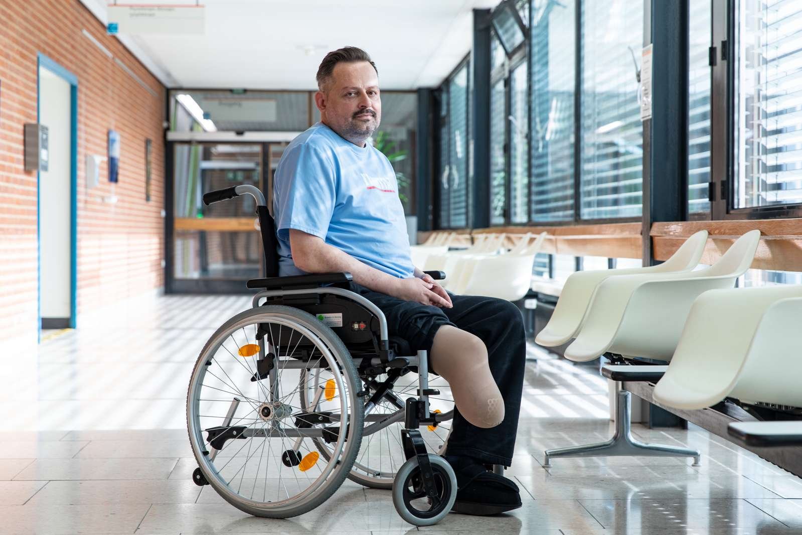 Copyright: Karin Kaiser / MHH Harte Lebensveränderung: Eine Amputation bringt sehr viele Einschränkungen mit sich. Copyright: Karin Kaiser / MHH