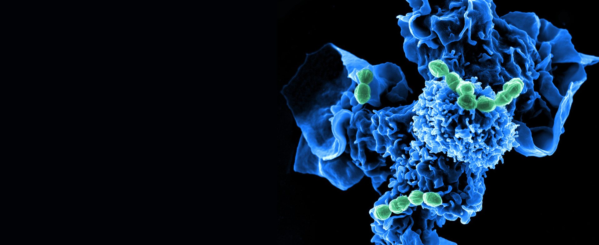 Eine digitale Röntgenaufnahme von einem mit Bakterien befallenen menschlichen Organ. 