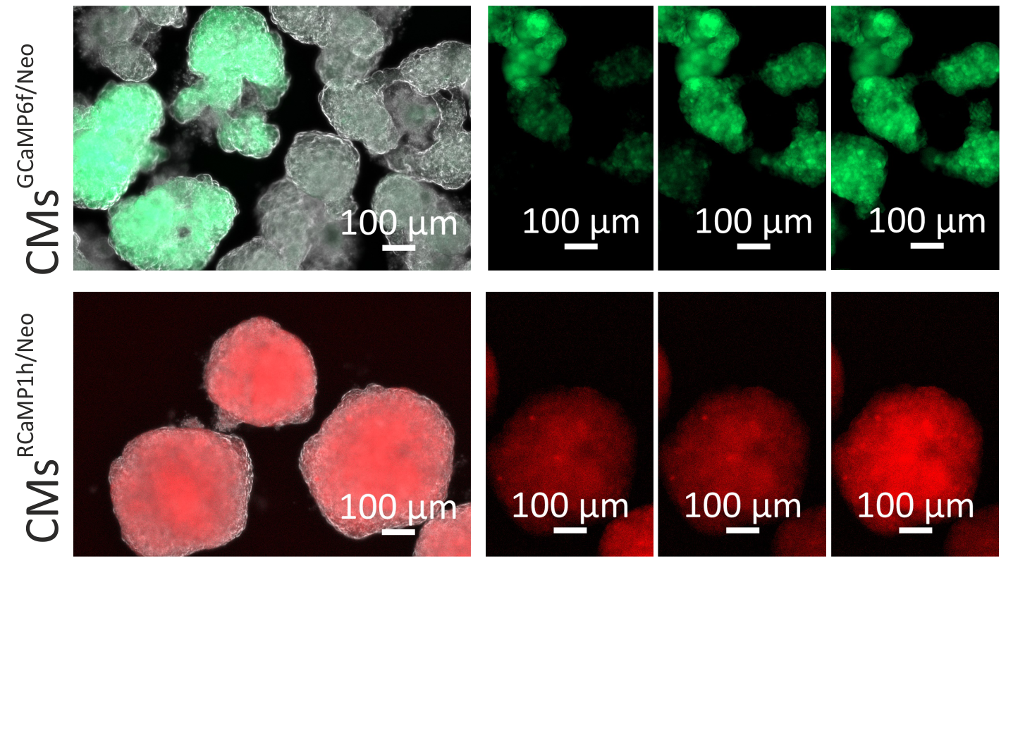 Mikroskopaufnahme, Zellen mit Kalziumindikatoren RCaMP1h and GCaMP6f