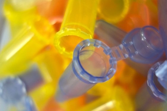 Copyright: Dr. Gustav Meyer / Zellbiochemie / MHH
