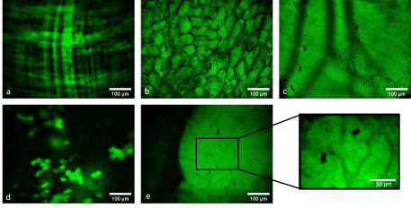 Fiber-based endoscopic in vivo visualization of jejunum, fat, blood vessel in the abdominal muscle, liver, pancreas with zoom-in on detailed structure in GFP-expressing mice.