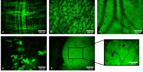 copyright: https://doi.org/10.1038/s41598-020-65950-w Fiber-based endoscopic in vivo visualization of jejunum, fat, blood vessel in the abdominal muscle, liver, pancreas with zoom-in on detailed structure in GFP-expressing mice.