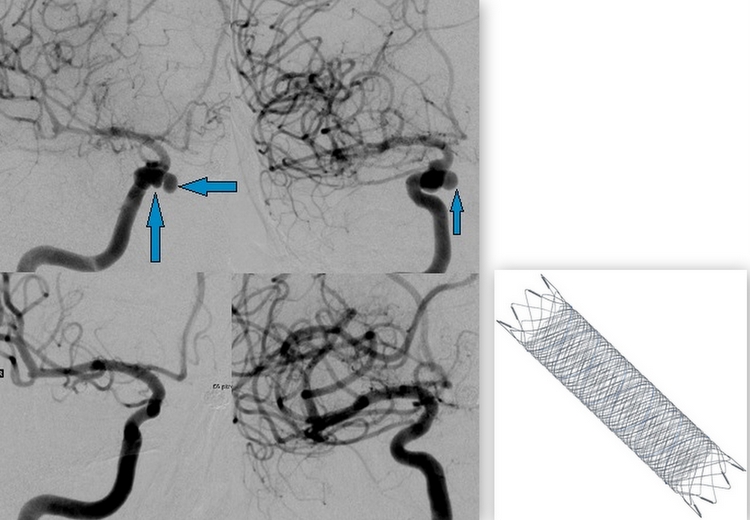 © Friedrich Götz/Neuroradiologie/MHH © Friedrich Götz/Neuroradiologie/MHH
