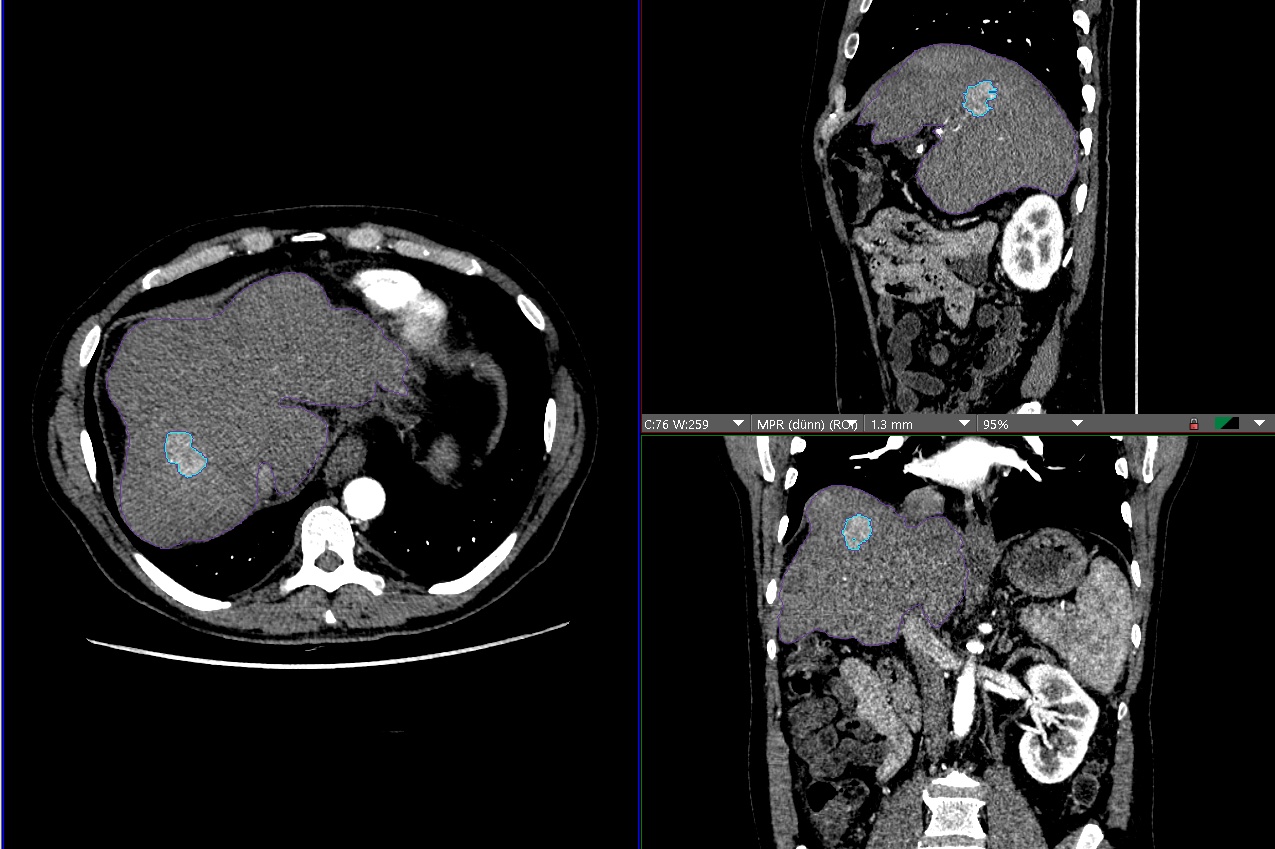 Diagnostische und Interventionelle Radiologie MHH