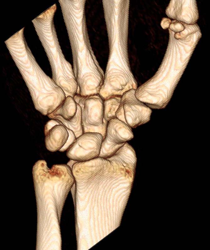 copyright:Diagnostische und Interventionelle Radiologie/MHH