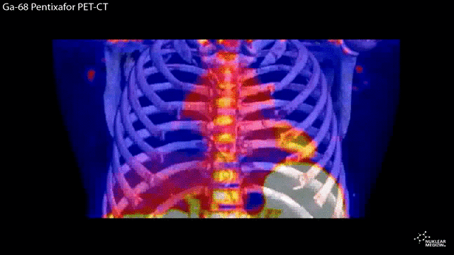 Frank Bengel / Klinik für Nuklearmedizin / MHH PET / CT - Hybrid bei Myokardinfarkt