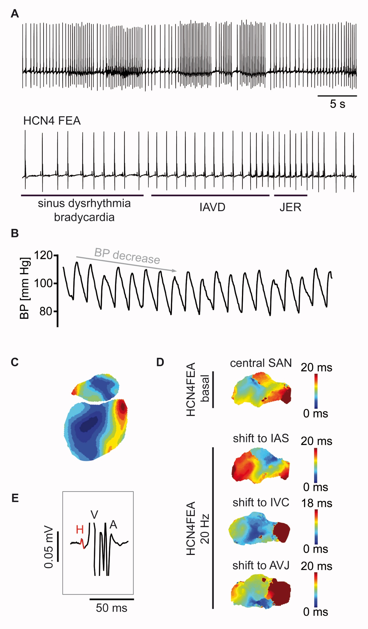 Wahl-Schott / Institut für Neurophysiologie / MHH